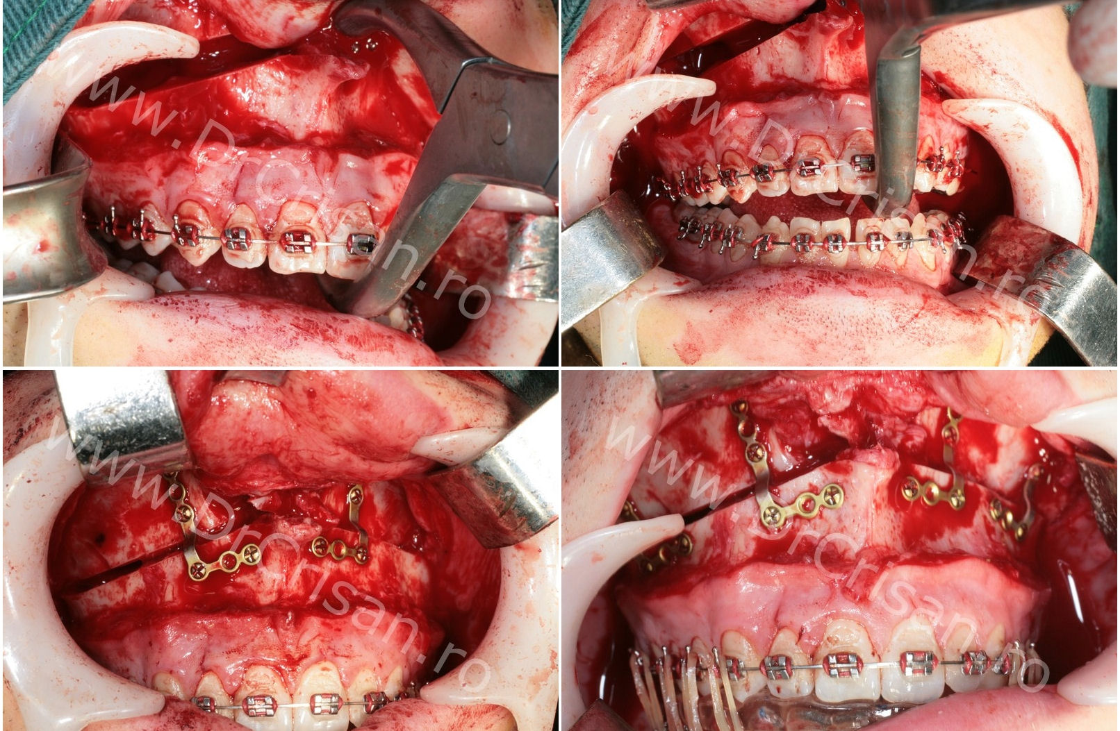 Smileclinic Dr.Crisan/Dr.Talpos Serban